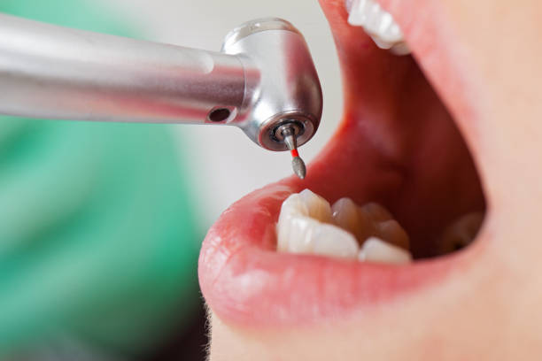Best Emergency Wisdom Teeth Removal in Muskegon Heights, MI
